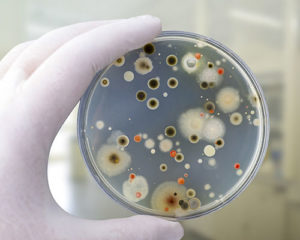 Petri dish shown bacterial and fecal contamination.